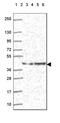 DnaJ Heat Shock Protein Family (Hsp40) Member B6 antibody, HPA058593, Atlas Antibodies, Western Blot image 
