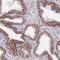 NADH:Ubiquinone Oxidoreductase Subunit B6 antibody, HPA044001, Atlas Antibodies, Immunohistochemistry frozen image 
