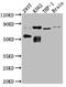 Protein Kinase C Theta antibody, CSB-RA978159A0HU, Cusabio, Western Blot image 