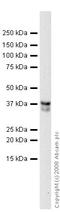 CD74 Molecule antibody, ab9514, Abcam, Western Blot image 