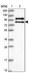 Activating Transcription Factor 6 Beta antibody, NBP1-91687, Novus Biologicals, Western Blot image 