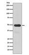 Cytochrome P450 Family 3 Subfamily A Member 4 antibody, M00339, Boster Biological Technology, Western Blot image 
