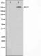 Acetyl-CoA Carboxylase Alpha antibody, GTX52372, GeneTex, Western Blot image 