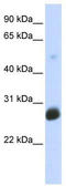 Ring Finger Protein 186 antibody, TA329881, Origene, Western Blot image 