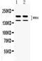 WRN RecQ Like Helicase antibody, PA5-80232, Invitrogen Antibodies, Western Blot image 