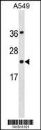 Programmed Cell Death 6 antibody, 60-784, ProSci, Western Blot image 