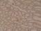 Catenin Delta 1 antibody, NBP2-77423, Novus Biologicals, Immunohistochemistry paraffin image 