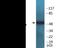 Tryptophan Hydroxylase 1 antibody, EKC2281, Boster Biological Technology, Western Blot image 