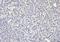 Itchy E3 Ubiquitin Protein Ligase antibody, M00195-1, Boster Biological Technology, Immunohistochemistry paraffin image 