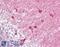 Protein Kinase C And Casein Kinase Substrate In Neurons 1 antibody, 45-103, ProSci, Immunohistochemistry paraffin image 