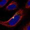 Zinc Finger Protein 365 antibody, PA5-62611, Invitrogen Antibodies, Immunofluorescence image 