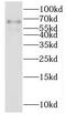 IKAROS Family Zinc Finger 3 antibody, FNab04206, FineTest, Western Blot image 