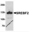 Sterol Regulatory Element Binding Transcription Factor 2 antibody, 7855, ProSci, Western Blot image 