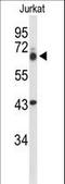 TLE Family Member 1, Transcriptional Corepressor antibody, LS-C161906, Lifespan Biosciences, Western Blot image 