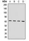 HIRA Interacting Protein 3 antibody, LS-C668549, Lifespan Biosciences, Western Blot image 