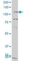 Guanylate Cyclase 2C antibody, H00002984-M05, Novus Biologicals, Western Blot image 