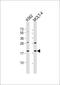 Gastrokine-1 antibody, 60-302, ProSci, Western Blot image 