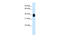 ETS Variant 7 antibody, 28-381, ProSci, Western Blot image 