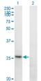 Fibrinogen Alpha Chain antibody, H00002243-M01, Novus Biologicals, Western Blot image 