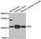 Insulin Degrading Enzyme antibody, TA327113, Origene, Western Blot image 