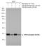 Ribosomal Protein S6 antibody, GTX132281, GeneTex, Western Blot image 