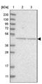Insulin Like Growth Factor 2 MRNA Binding Protein 1 antibody, NBP1-83108, Novus Biologicals, Western Blot image 