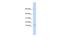 Keratin Associated Protein 8-1 antibody, A14121, Boster Biological Technology, Western Blot image 