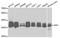 Tripeptidyl Peptidase 1 antibody, A5627, ABclonal Technology, Western Blot image 