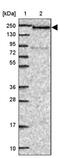Death Inducer-Obliterator 1 antibody, PA5-62085, Invitrogen Antibodies, Western Blot image 