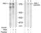 Insulin Receptor Substrate 1 antibody, GTX79037, GeneTex, Western Blot image 