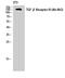 Transforming Growth Factor Beta Receptor 3 antibody, A02765-3, Boster Biological Technology, Western Blot image 