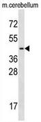 Transcription Factor 7 Like 2 antibody, AP54203PU-N, Origene, Western Blot image 