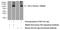 Hexokinase 3 antibody, 13333-1-AP, Proteintech Group, Western Blot image 