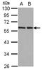 RAD23 Homolog B, Nucleotide Excision Repair Protein antibody, LS-B10763, Lifespan Biosciences, Western Blot image 