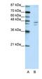Zinc Finger Protein 419 antibody, orb324808, Biorbyt, Western Blot image 