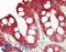 Keratin 20 antibody, LS-B14847, Lifespan Biosciences, Immunohistochemistry paraffin image 