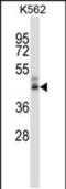 Zinc Finger DHHC-Type Containing 16 antibody, PA5-48671, Invitrogen Antibodies, Western Blot image 