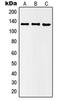 Histone Deacetylase 5 antibody, LS-C353224, Lifespan Biosciences, Western Blot image 