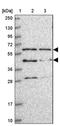 TRNA Methyltransferase 6 antibody, PA5-61409, Invitrogen Antibodies, Western Blot image 