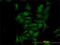 Cyclin Dependent Kinase 4 antibody, H00001019-M03, Novus Biologicals, Immunofluorescence image 