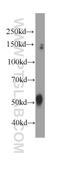 Dynactin subunit 2 antibody, 60257-1-Ig, Proteintech Group, Western Blot image 