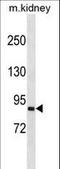 Semaphorin 4A antibody, LS-C168954, Lifespan Biosciences, Western Blot image 