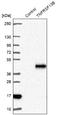 TNF Receptor Superfamily Member 13B antibody, NBP1-84596, Novus Biologicals, Western Blot image 