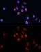SMAD Family Member 5 antibody, GTX32881, GeneTex, Immunofluorescence image 