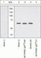 Protein Tyrosine Kinase 2 Beta antibody, GTX24805, GeneTex, Western Blot image 