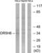 Olfactory Receptor Family 5 Subfamily H Member 1 antibody, LS-C120891, Lifespan Biosciences, Western Blot image 