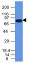 Transforming Growth Factor Alpha antibody, orb388704, Biorbyt, Western Blot image 