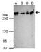 ATM Serine/Threonine Kinase antibody, GTX77613, GeneTex, Western Blot image 