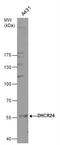 24-Dehydrocholesterol Reductase antibody, NBP1-32247, Novus Biologicals, Western Blot image 