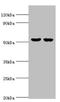 Glucosylceramidase Beta 3 (Gene/Pseudogene) antibody, orb353070, Biorbyt, Western Blot image 